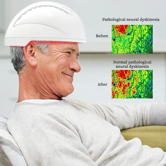 Suyzeko Neuro Stimulation Helmet Аппарат для терапии инфракрасным светом для фотобиомодуляционной терапии